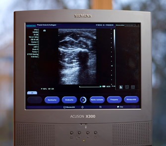 Foto Monitor mit Ultraschallaufnahme